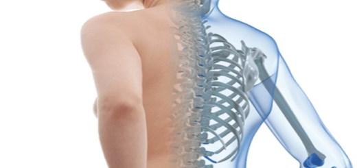 Сколиоз лечение