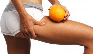 как убрать целлюлит