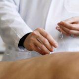 Иглорефлексотерапия для взрослых и детей