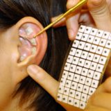 Постановка аурикулярных кнопок