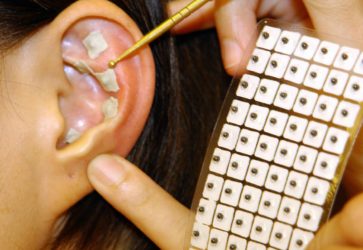 Постановка аурикулярных кнопок