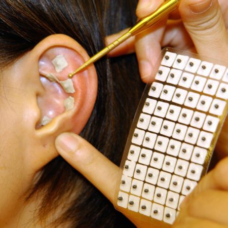 Постановка аурикулярных кнопок