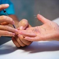 Акупунктура Су Джок