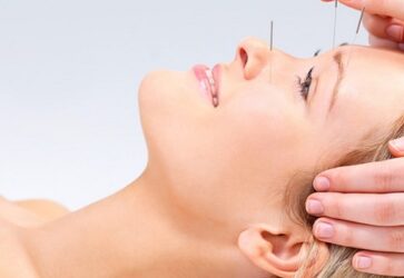 Косметическая лицевая акупунктура