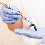 Первичная консультация гирудотерапевта