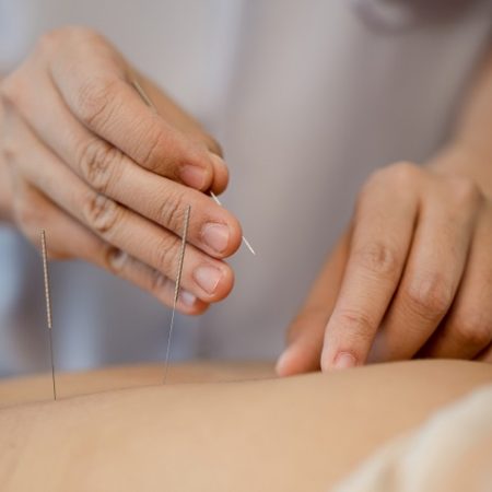 Иглотерапия по Нэй Цзин (одной иглой)