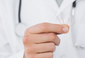 Консультация иглорефлексотерапевта